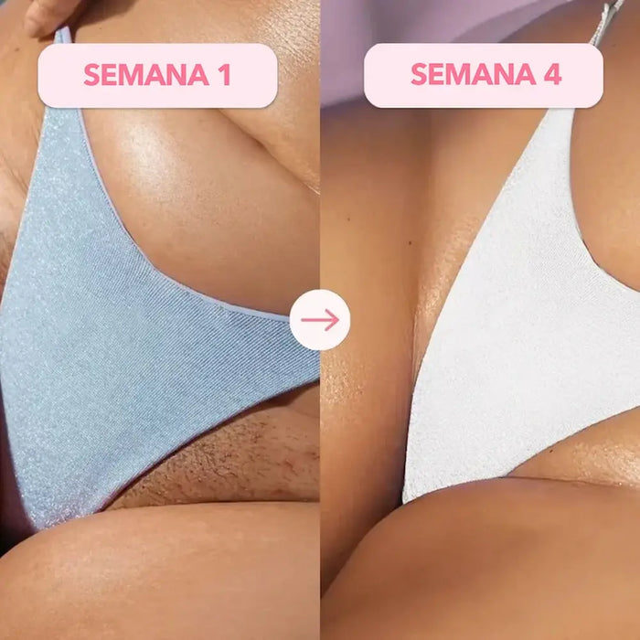 ↓ Resultados Permanentes ↓😱 en 3 semanas 😱