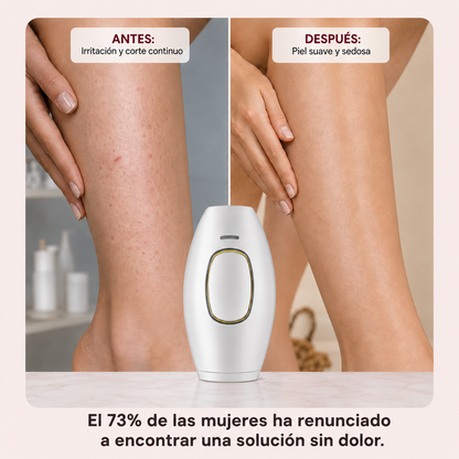 LUZVERA™ – Depiladora IPL: Piel suave y sin vello para siempre