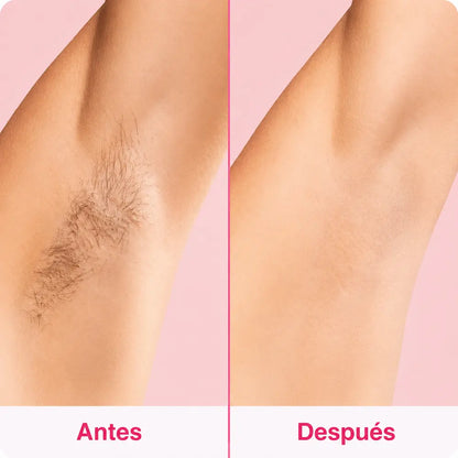 SKINLUME™ – Depiladora laser permanente
