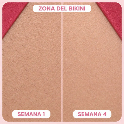 SKINLUME™ – Depiladora laser permanente