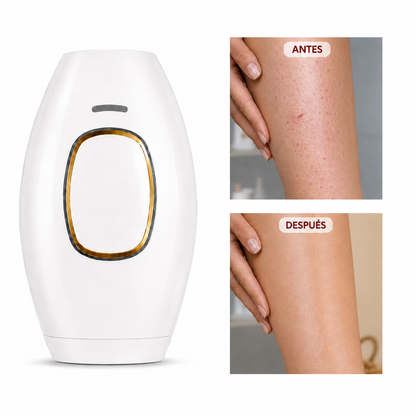 LUZVERA™ – Depiladora IPL: Piel suave y sin vello para siempre