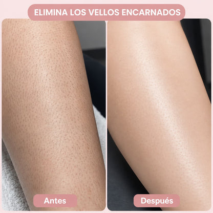 SUAVELLE™ - Depiladora 2 en 1 (Depilación Sin Irritación para tu Piel Más Sensible)