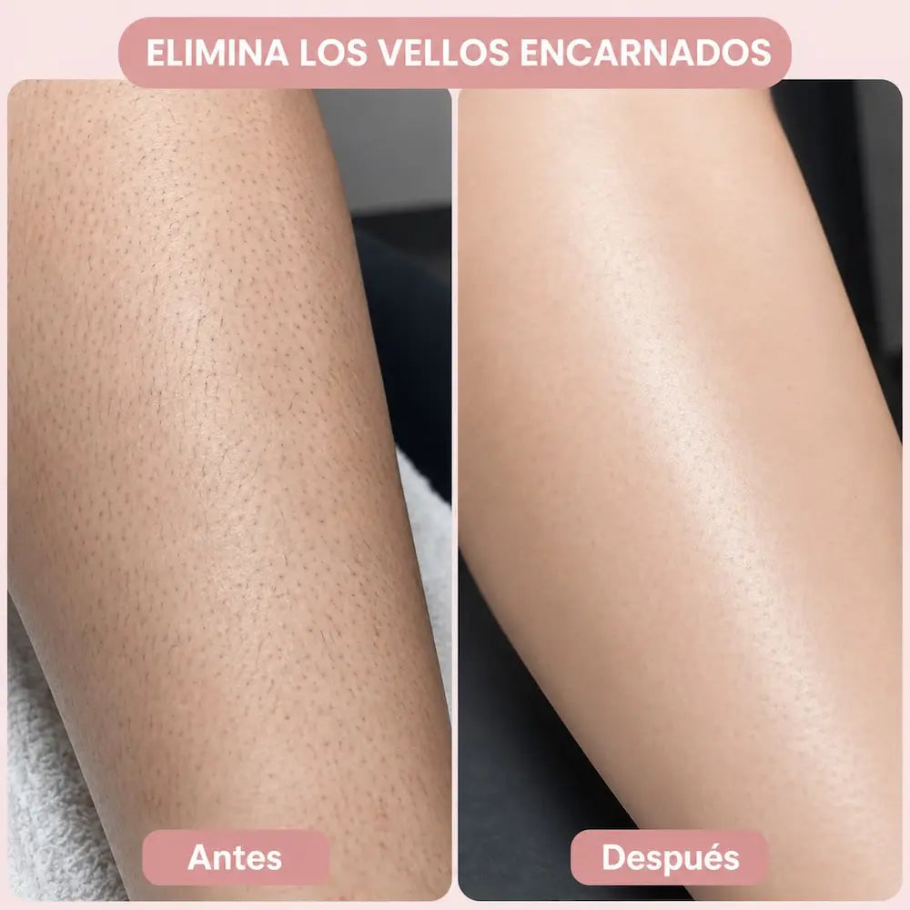 SUAVELLE™ - Depiladora 2 en 1 (Depilación Sin Irritación para pieles Sensible)