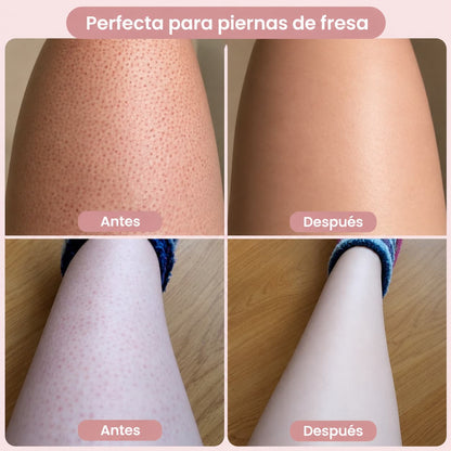 SUAVELLE™ - Depiladora 2 en 1 (Depilación Sin Irritación para tu Piel Más Sensible)