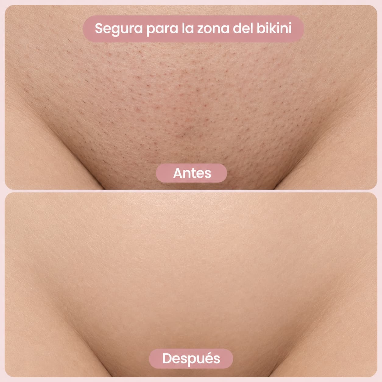SUAVELLE™ - Depiladora 2 en 1 (Depilación Sin Irritación para tu Piel Más Sensible)