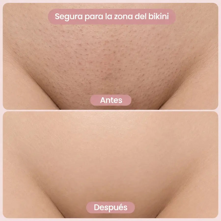 SUAVELLE™ - Depiladora 2 en 1 (Depilación Sin Irritación para pieles Sensible)