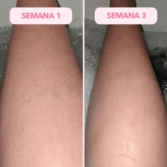 ↓ ALIVIO DESDE LA PRIMERA APLICACIÓN↓