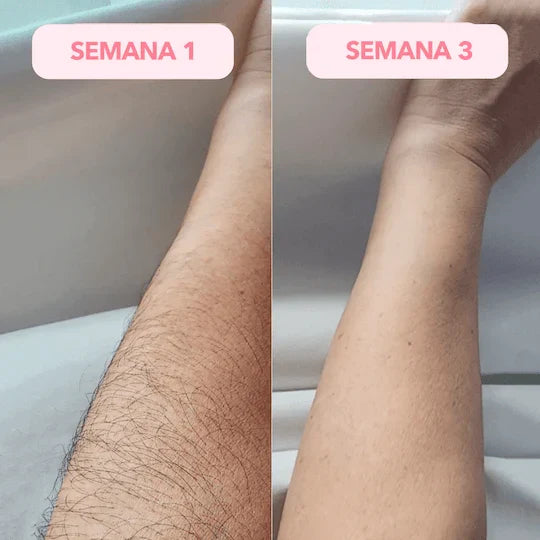 ↓ ALIVIO DESDE LA PRIMERA APLICACIÓN↓